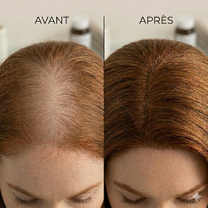 Folixa - Fibre capillaire